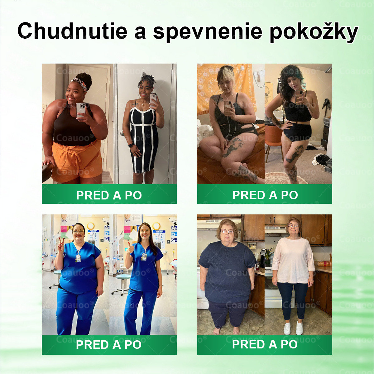 🔥 𝐂𝐨𝐚𝐮𝐨𝐨® Moringa × Berberín × AMPK 10-v-1 Metabolická podpora – nanomikroihlová náplasť (Stačí raz denne, viditeľné výsledky už za 7 dní)  ✅ Na obezitu, ochabnutú pokožku, cukrovku, spánkové apnoe, problémy s kĺbmi a mnohé ďalšie ťažkosti 🔥