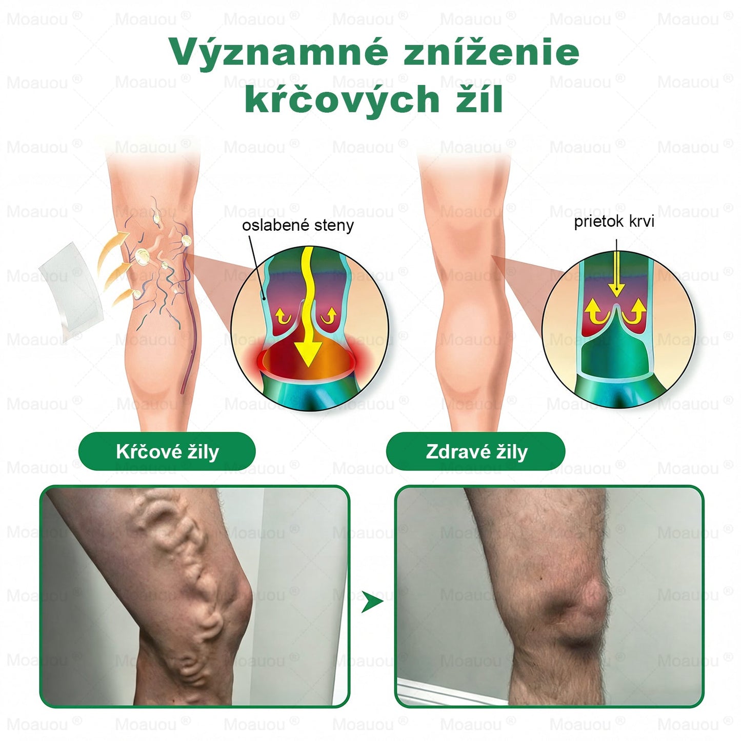 🎁 Zostáva iba 5 boxov! Teraz s extra 50% zľavou! Posilnite svoje telo, žite zdravo! Konajte teraz – budúci rok už nebude šanca!